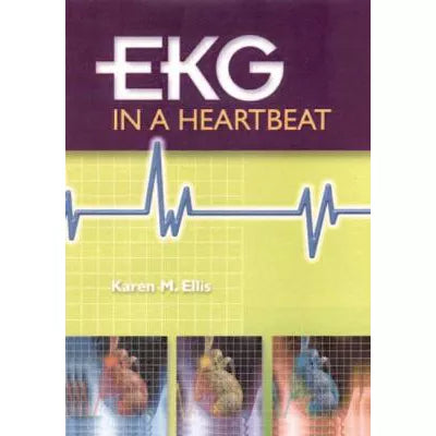 EKG in a Heartbeat